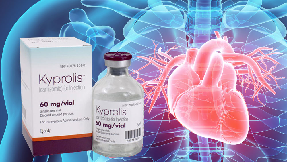 Carfilzomib Cardiovascular Risk