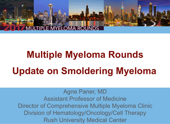 Focus on Smoldering Multiple Myeloma